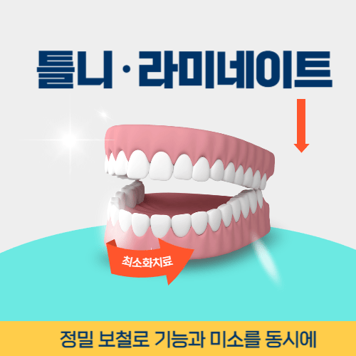원주치과 원주시 치과 틀니 라미네이트